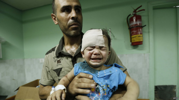 Criança ferida em bombardeio à escola da ONU. Crédito: AFP