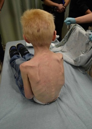 Médicos do Hospital Infantil do Texas examinam criança desnutrida encontrada por policiais trancada dentro de um armário em uma casa no Texas (EUA)