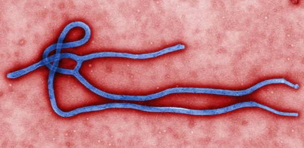 Micrografia eletrônica colorida de transmissão feita nos EUA mostra um pouco da morfologia de uma partícula viral do Ebola; vírus pode levar à morte
