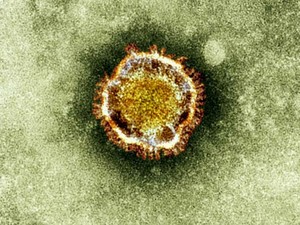 Imagem divulgada pela agência britânica de proteção à saúde mostra o coronavírus visto ao microscópio (Foto: AFP)