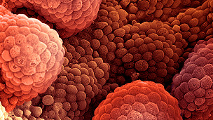 Células de câncer de próstata