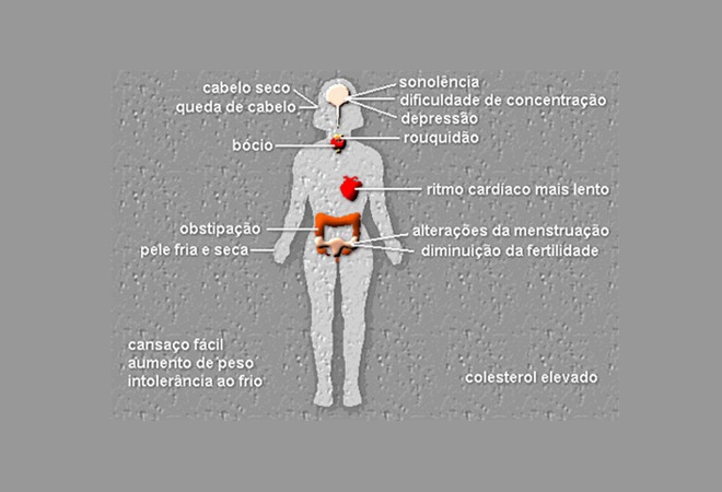 Sintomas do Hipotiroidismo