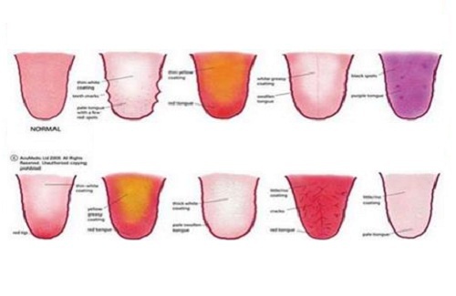 A língua pode revelar seu estado emocional e de saúde