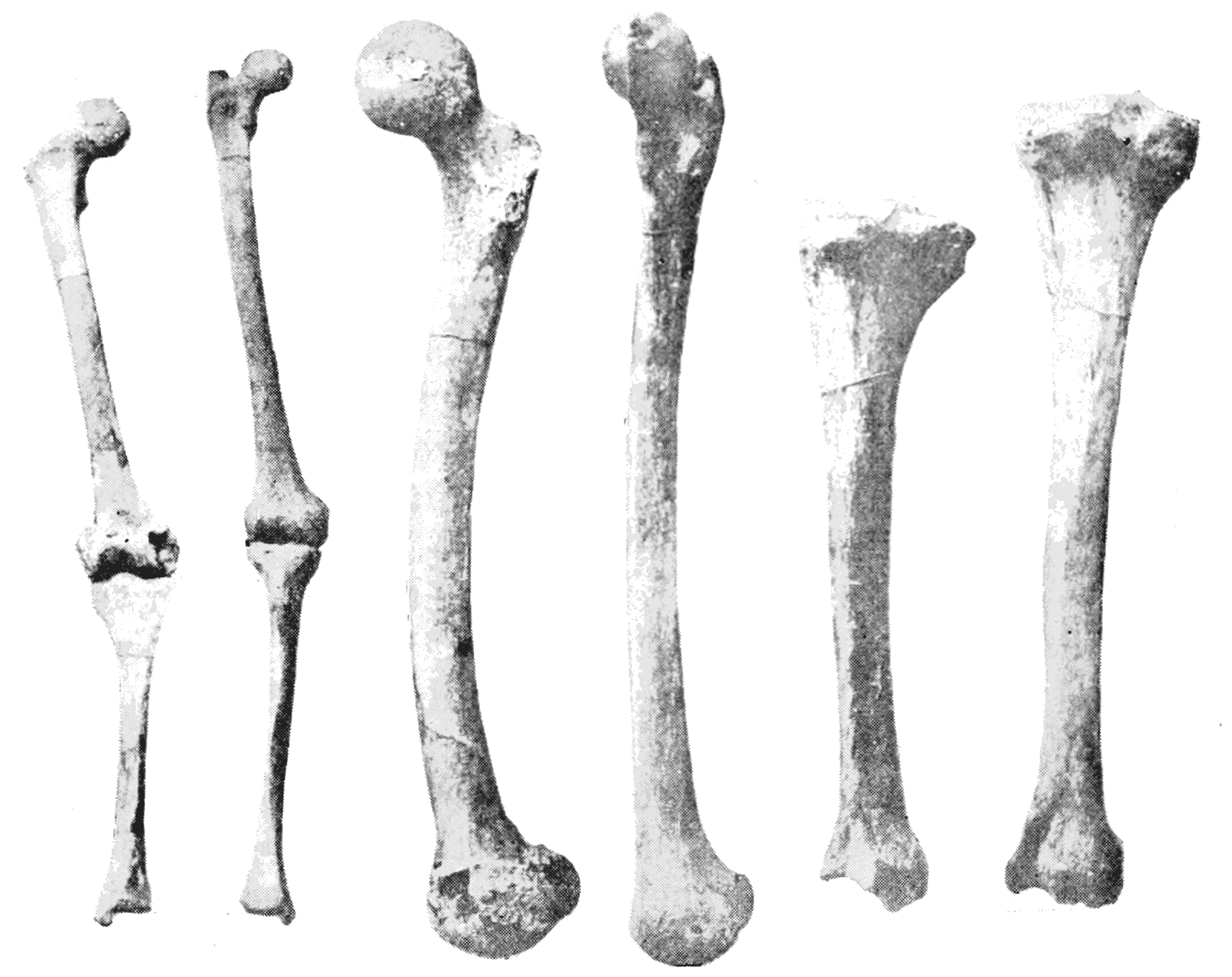 PSM_V44_D639_Showing_leg_bones