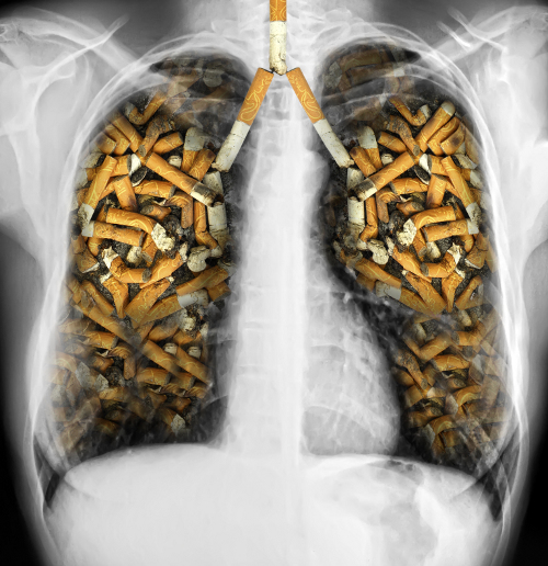 Pulmones-cigarros